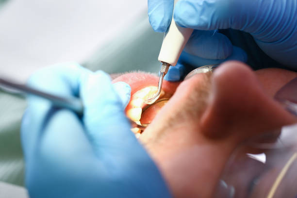 Best Emergency Root Canal Treatment in Lockhart, TX