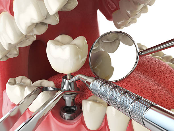 Best Emergency Treatment for Toothache in Lockhart, TX